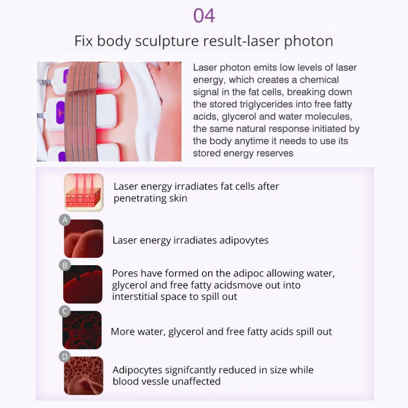 9 in 1 cavitation machine Benefits advantages