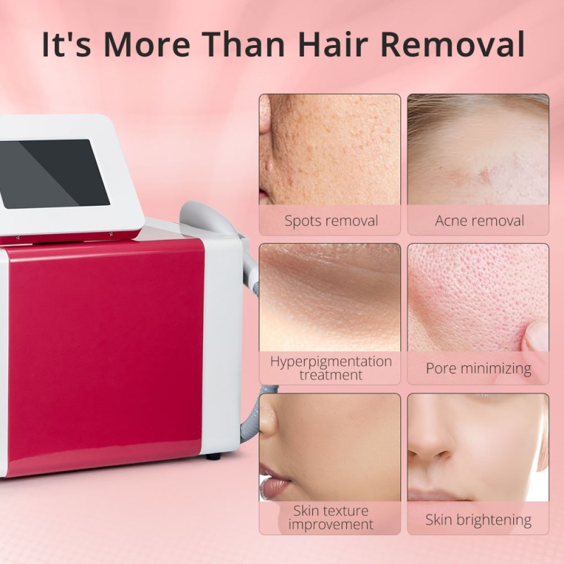 laser hair removal shr